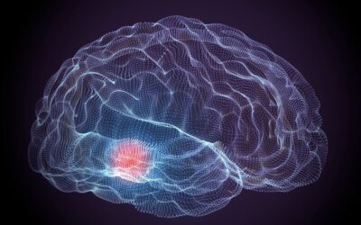 Parkinson